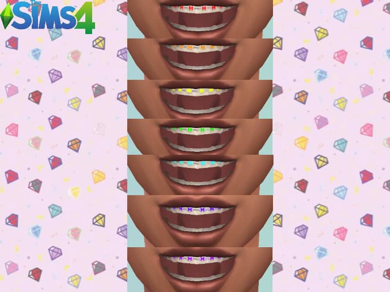 Colored Braces