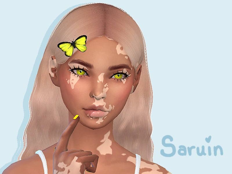 Skin Detail Vitiligo Set