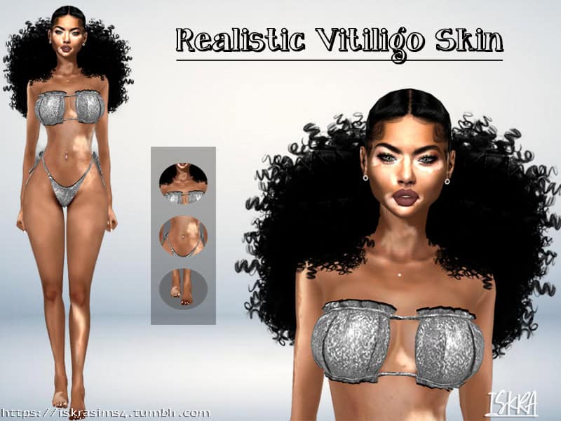 ISKRA Realistic Vitiligo Skin
