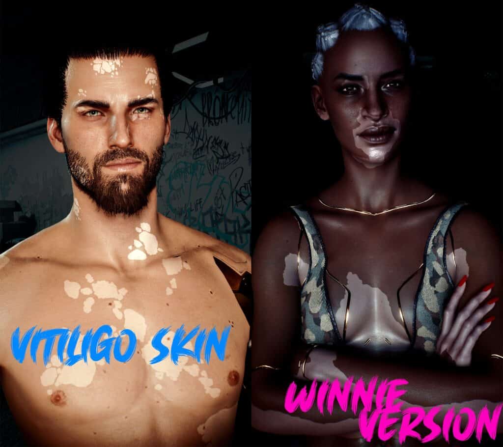 2 Vitiligo Skins for Masc & Femme V