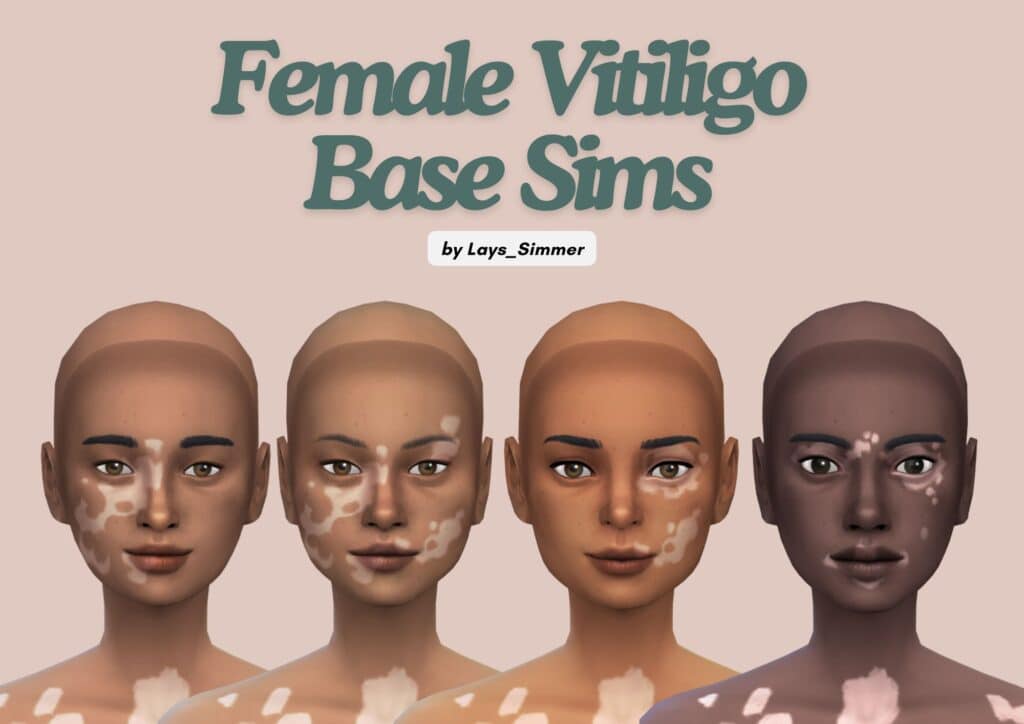 Vitiligo Female Base Sim