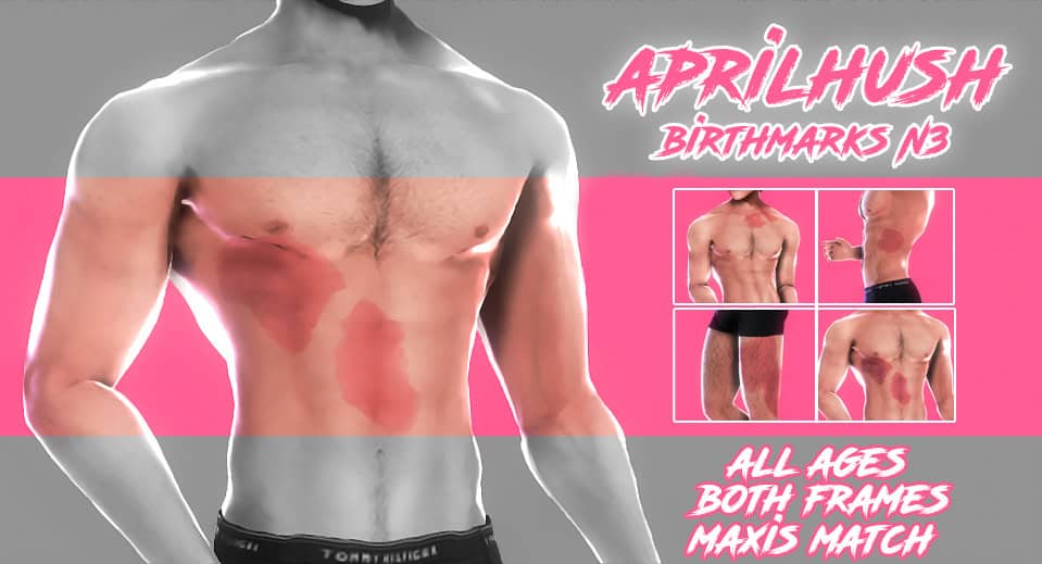 Birthmarks N3