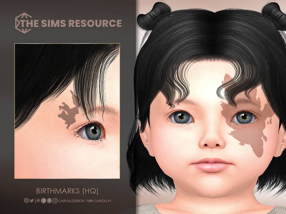Birthmarks