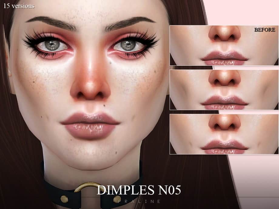 Dimples NO5