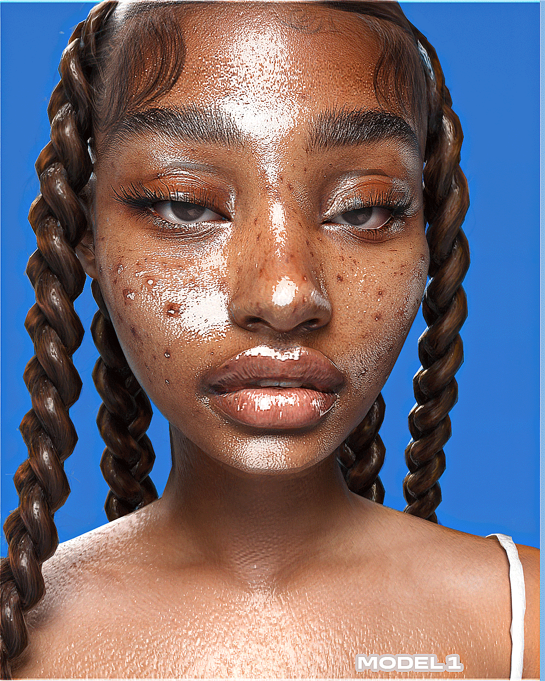 Acne