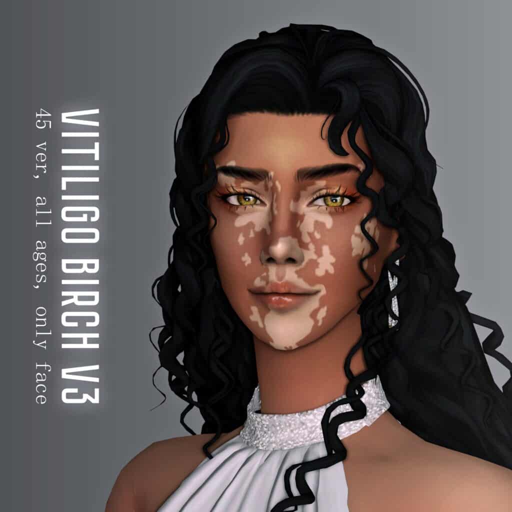 Vitiligo “Birch” Version 3