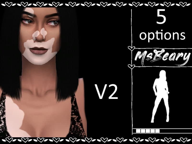 Vitiligo Skin V2