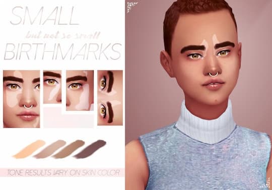 Small Birthmarks