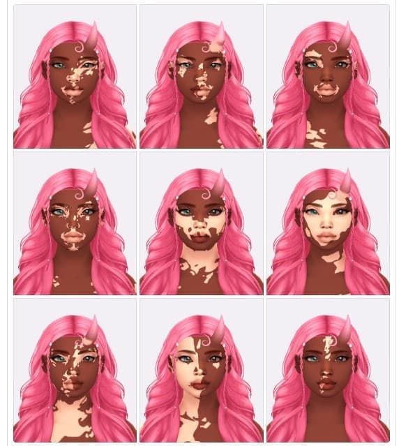 Vitiligo Sets 1 + 2