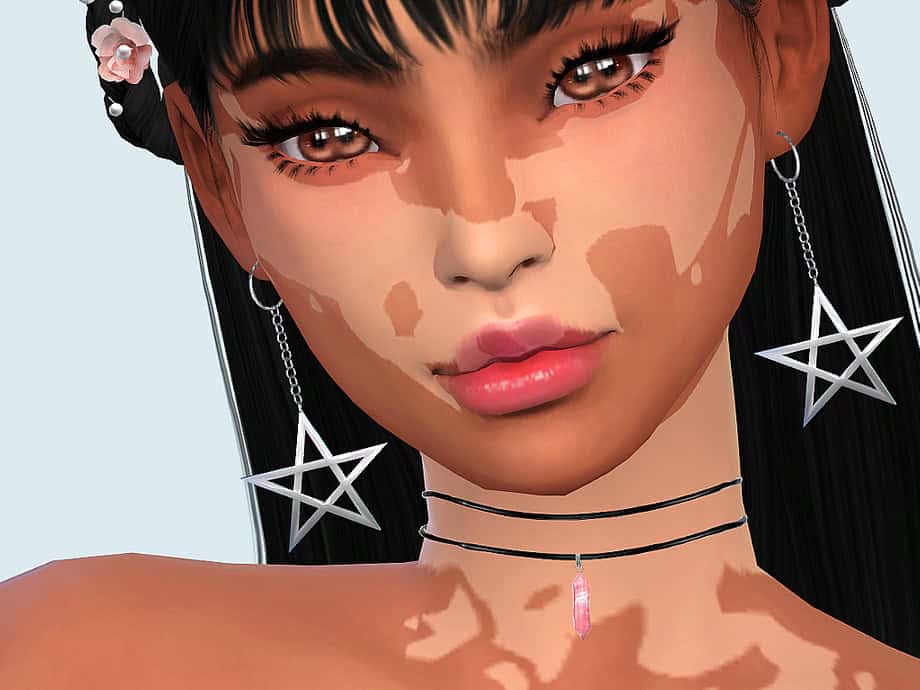 Skin Detail Vitiligo Set No. 2