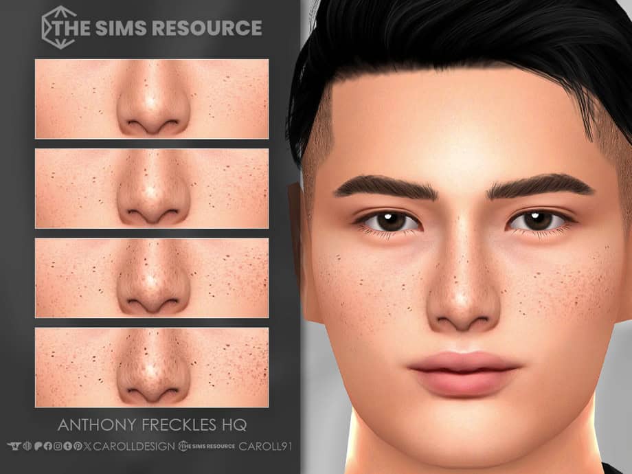 Anthony Freckles