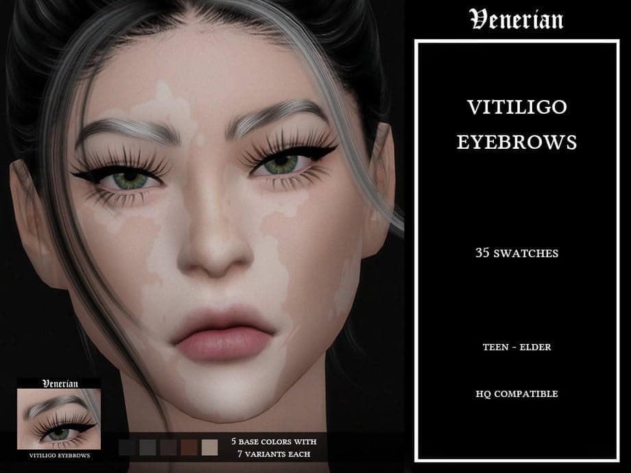 Vitiligo Eyebrows