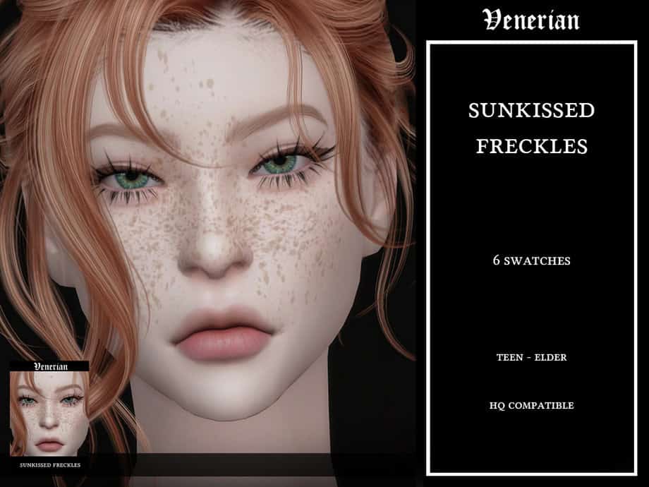 Sunkissed Freckles