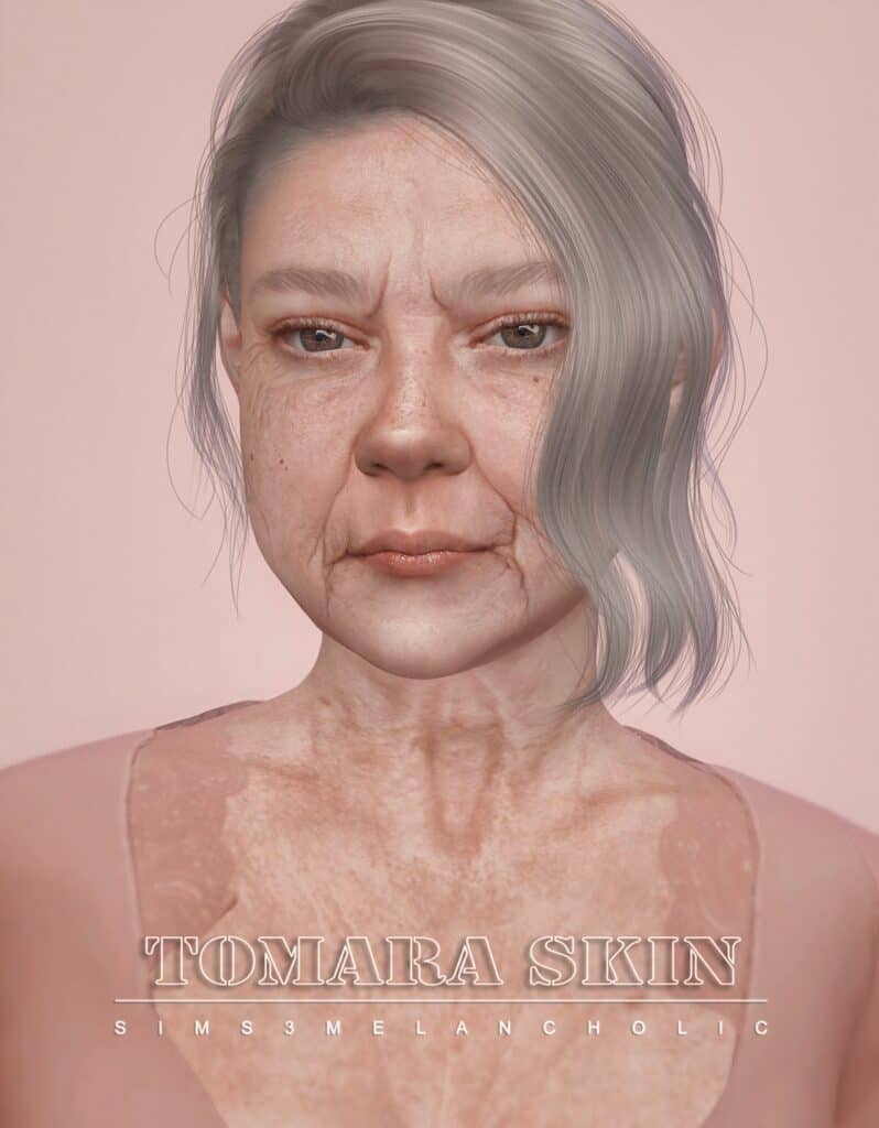 Tamara Skin