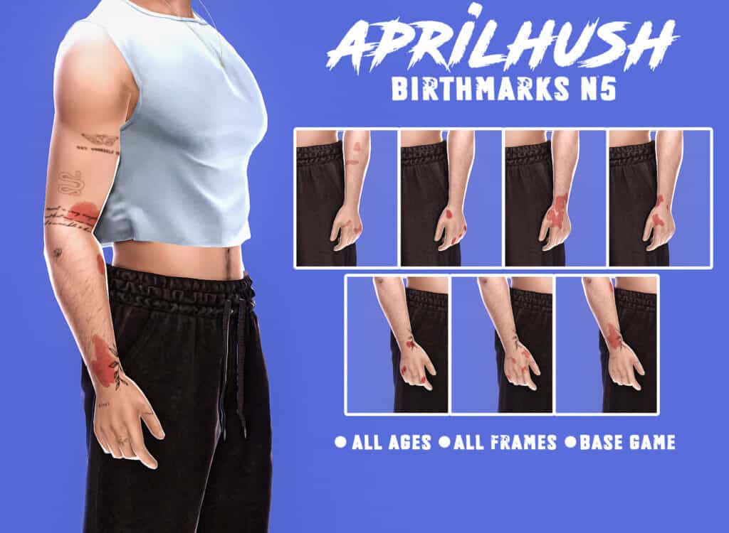 Birthmarks N5