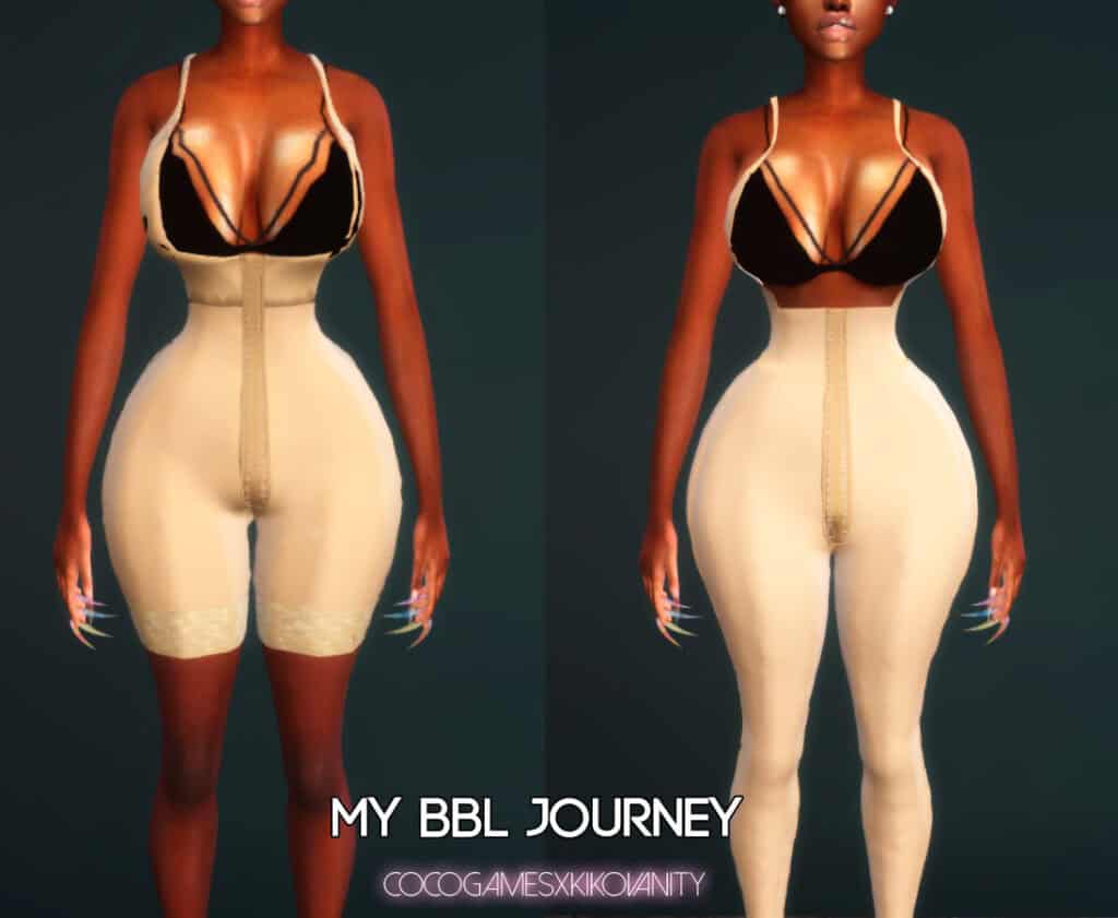 My BBL Journey