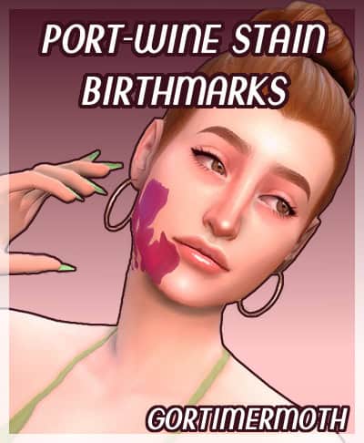 Port Wine Stain Birthmarks