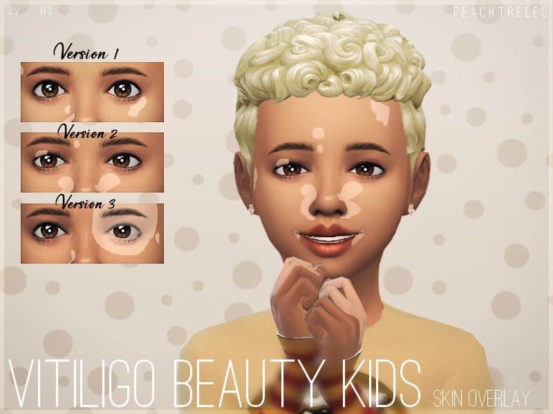 Kids Vitiligo Beauty Skin Overlay