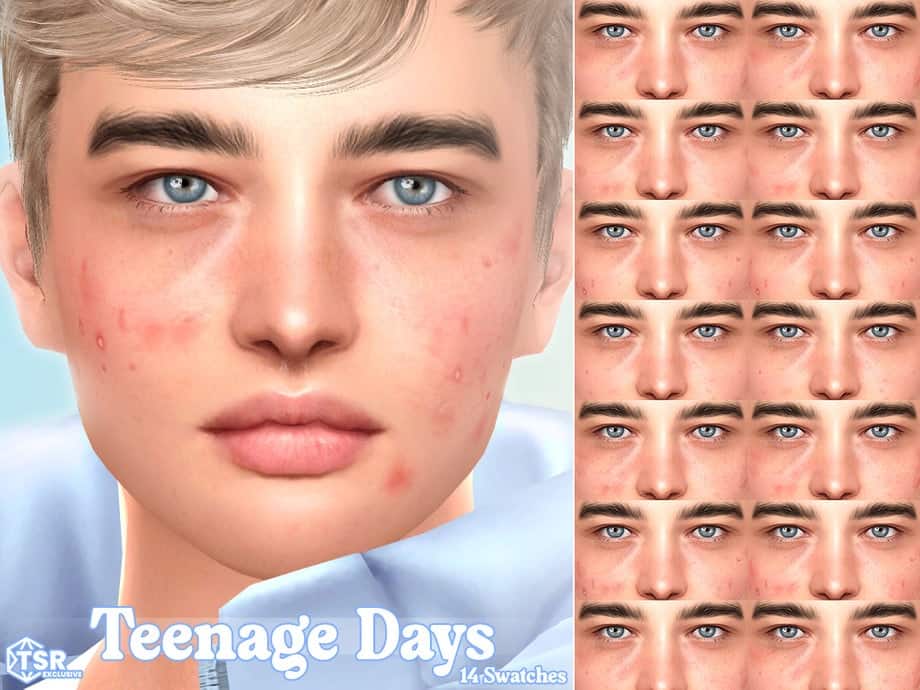 Teenage Days - Acne