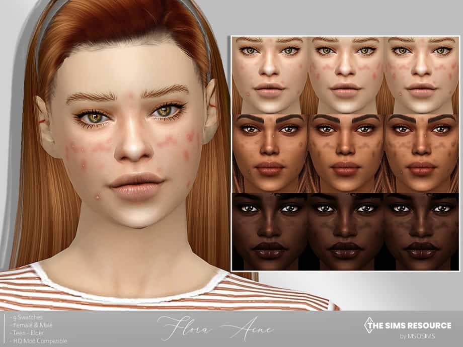 Flora Acne